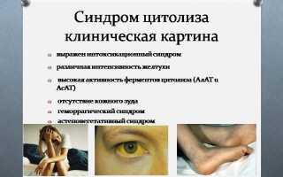 Токсический гепатит с синдромом цитолиза