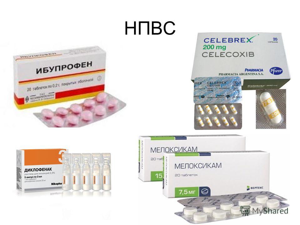 Физиолечение при синдроме грушевидной мышцы