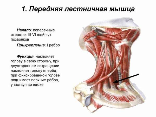Синдром передней лестничной мышцы лечение