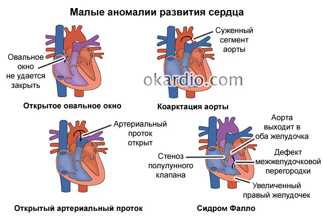 возможные сердечные аномалии