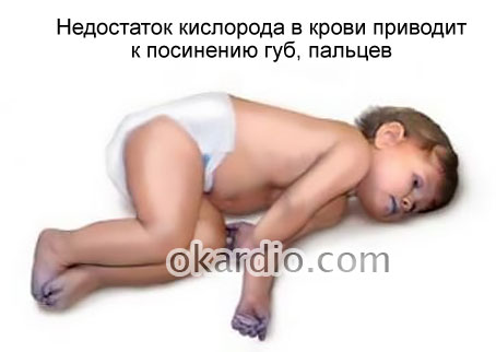 цианоз