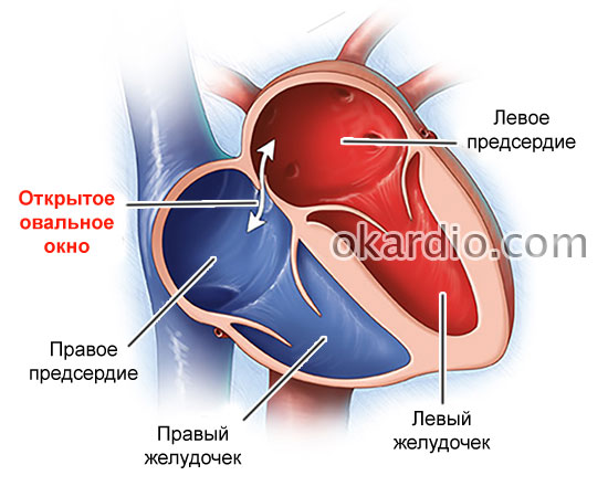 открытое овальное окно