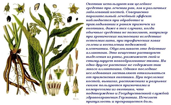 Физиолечение при синдроме грушевидной мышцы