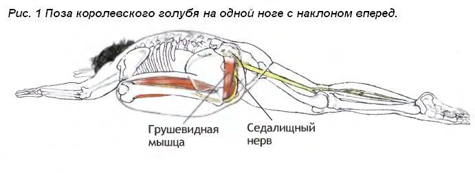 Физиолечение при синдроме грушевидной мышцы