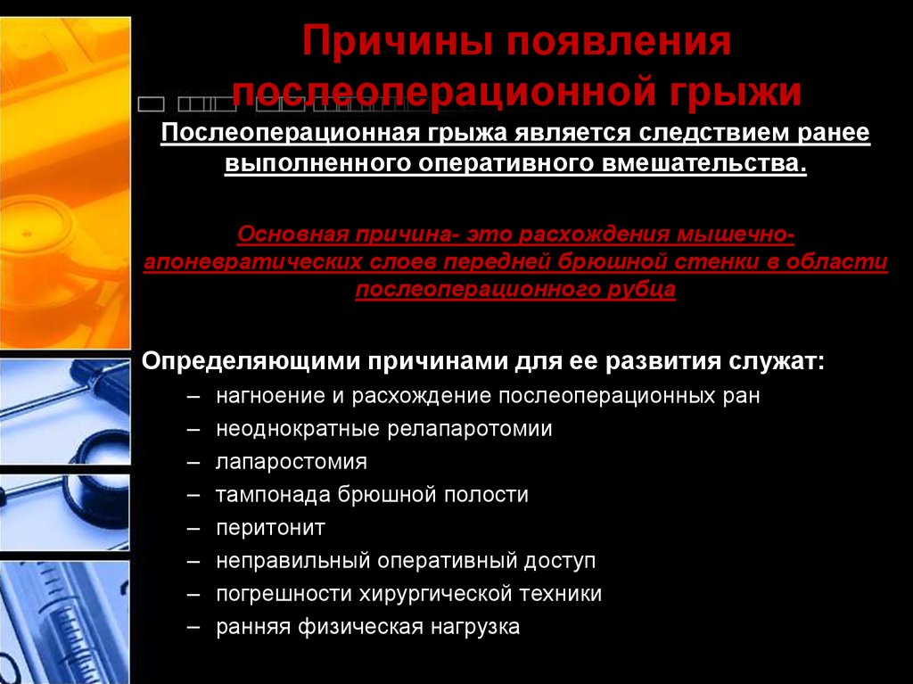 Ущемленная послеоперационная вентральная грыжа код мкб