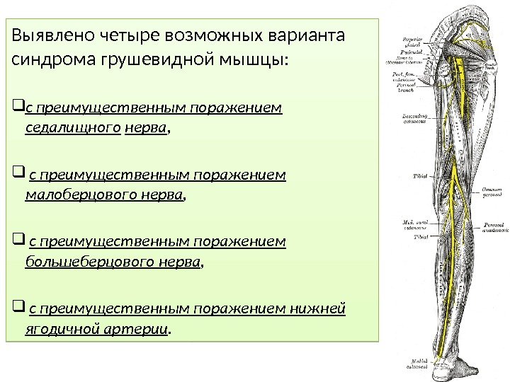 Физиолечение при синдроме грушевидной мышцы